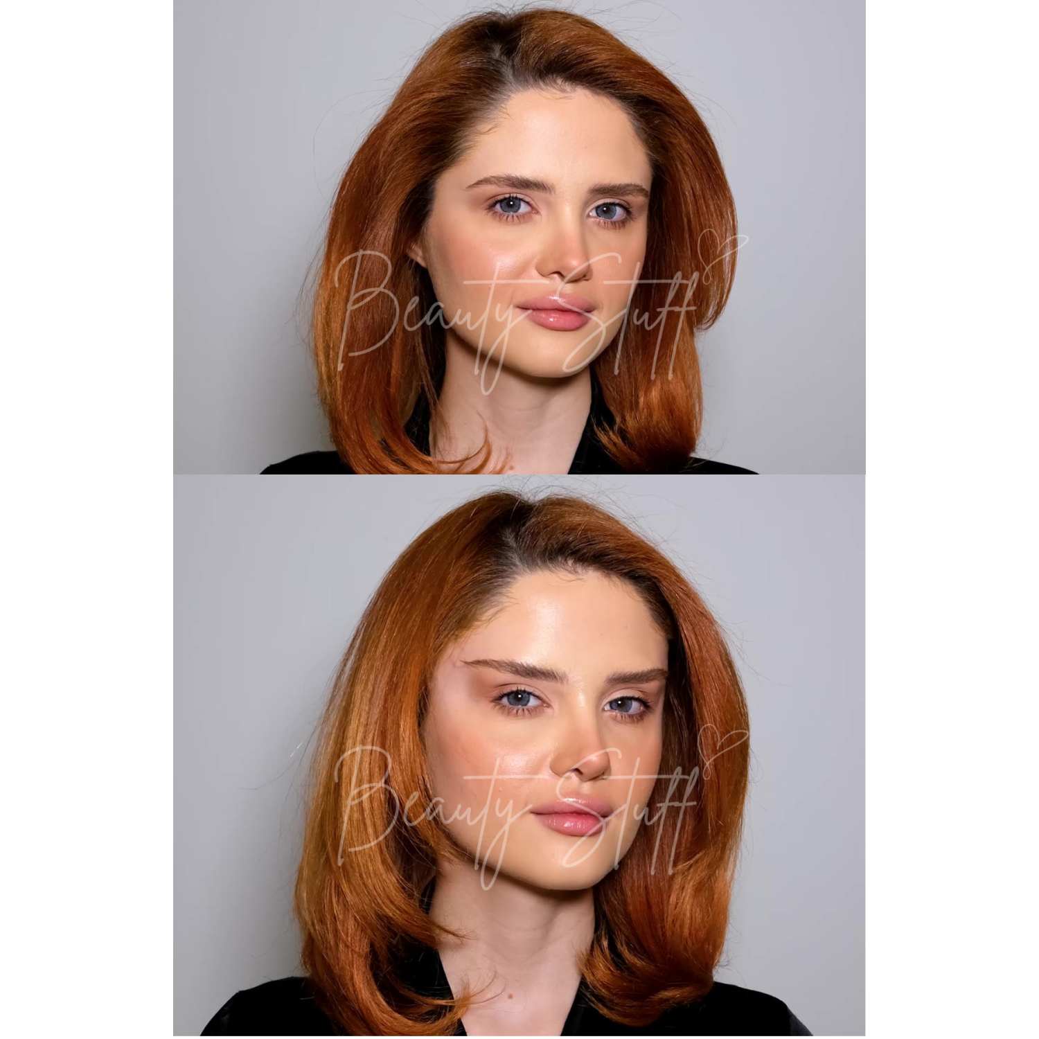 Siyah Lastikli Lift 'Em Up Yüz & Göz Germe Bantları (20'li paket) (Made in USA)