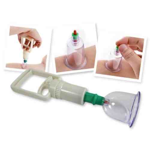 6'lı Vakumlu Bardak Hacamat seti